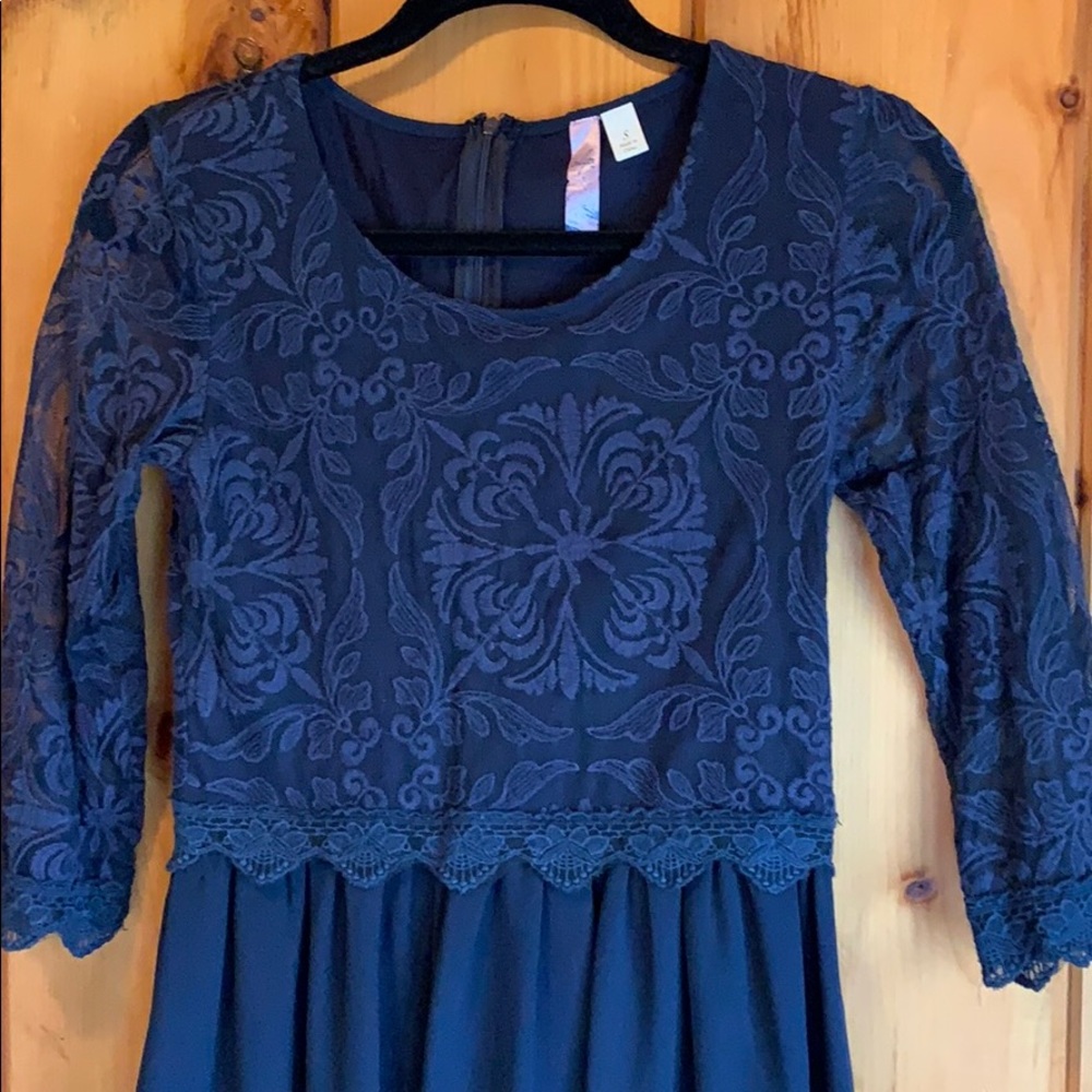 Francesca’s lace dress